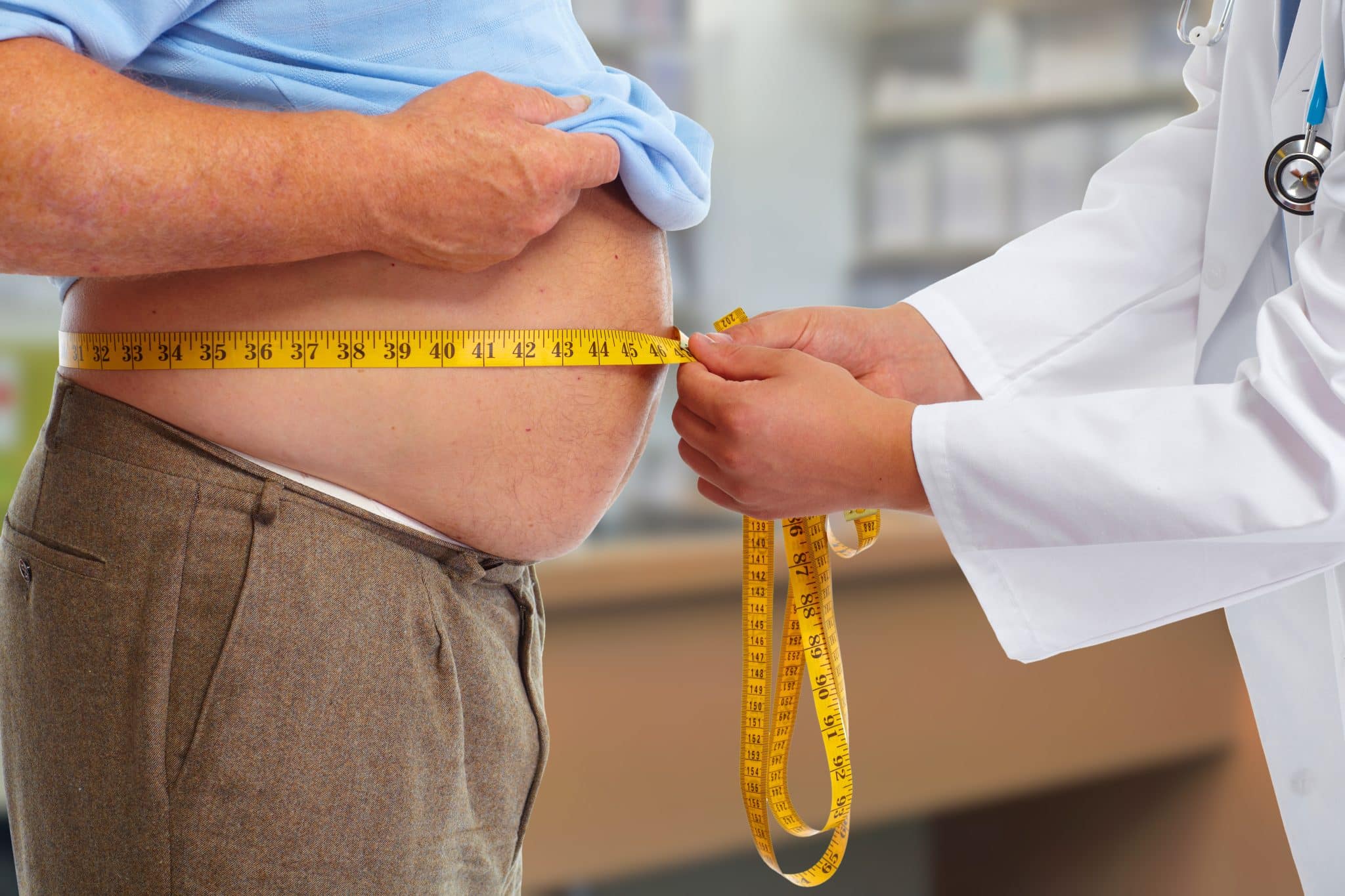 Doctor measuring obese man's stomach as part of medically supervised weight loss